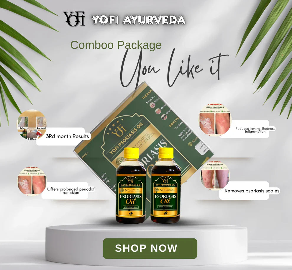 Vida Herbals Psoriasis Oil-Advanced Psoriasis Clearing Oil